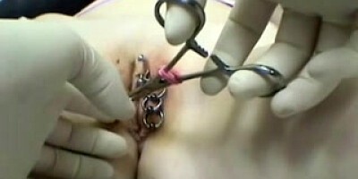 Piercing my external g-spot with eight rings - final piercing