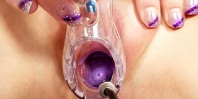 Zaneta has her vagina gyno buttplug investigated by old doctor