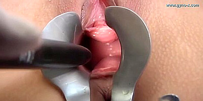 In Teen 18+ Gyno Examination - Lola Myluv