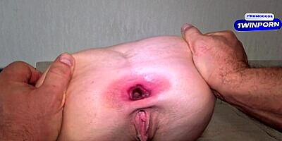 Deep anal - wide gaping ass